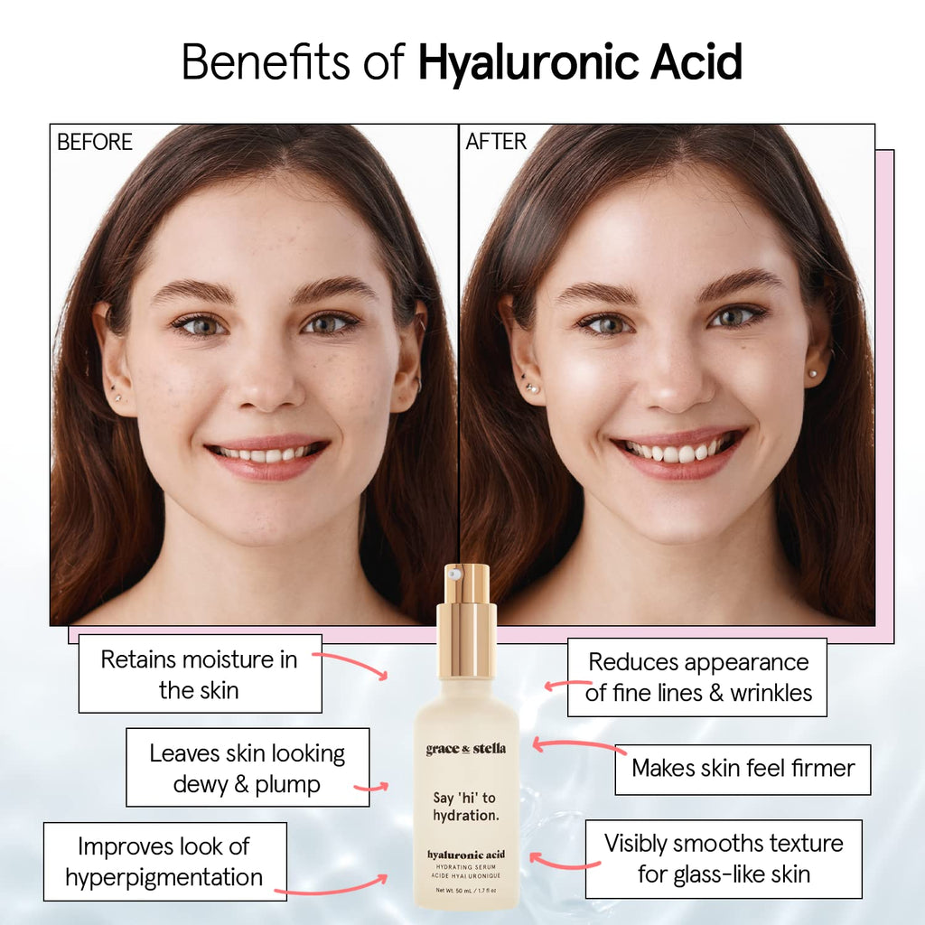 grace & stella Award Winning Hyaluronic Acid Serum (50ml/1.7 fl oz) Hydrating Hyaluronic Acid Serum for Face - Acido Hialuronico for Women - Remove Fine Lines, Wrinkles, Anti Aging - Vegan Skincare in Pakistan