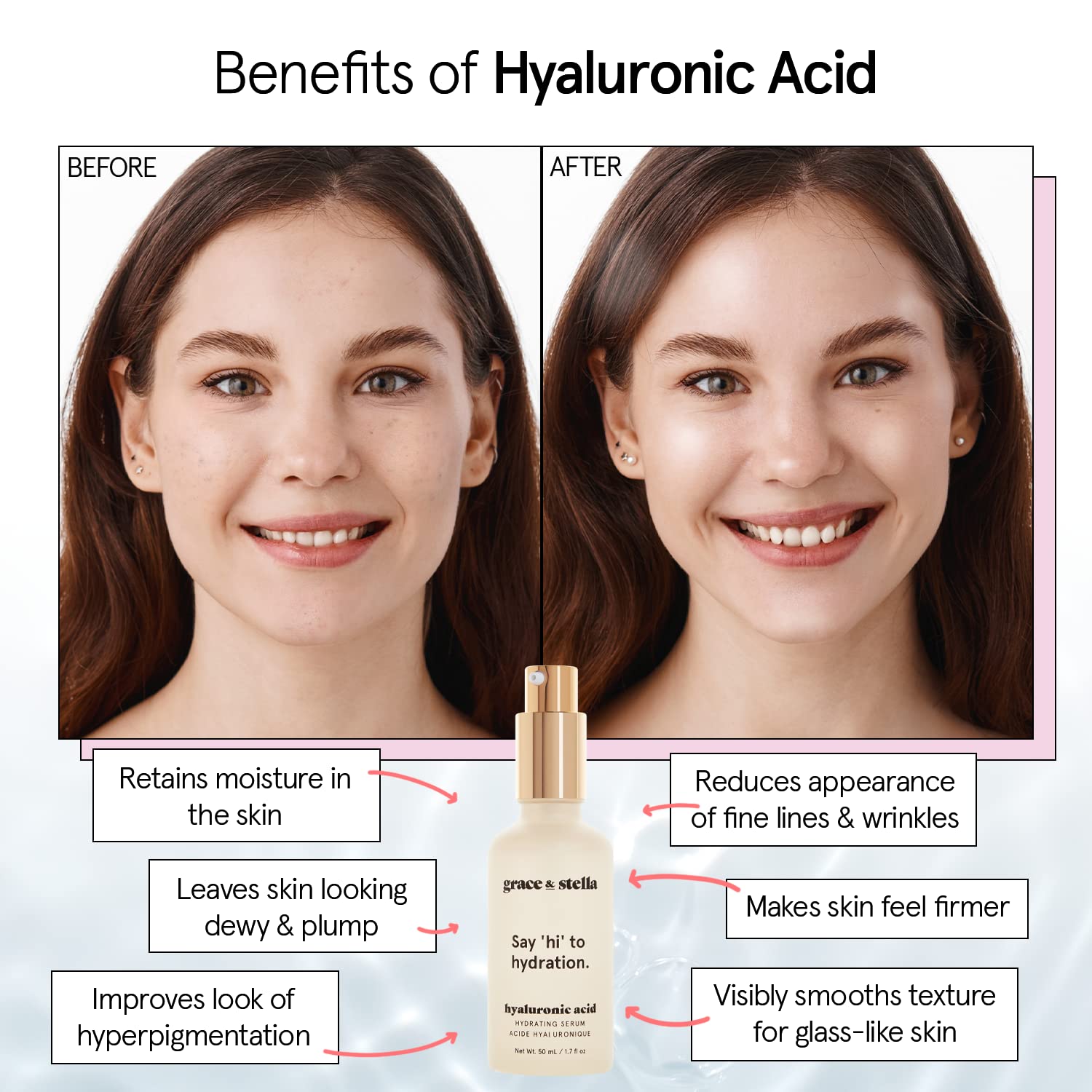 grace & stella Award Winning Hyaluronic Acid Serum (50ml/1.7 fl oz) Hydrating Hyaluronic Acid Serum for Face - Acido Hialuronico for Women - Remove Fine Lines, Wrinkles, Anti Aging - Vegan Skincare in Pakistan