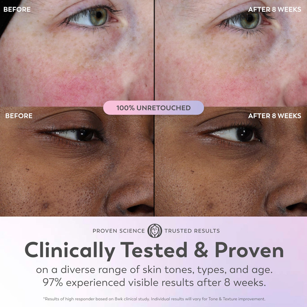 Olay Super Serum - Niacinamide, Vitamin C & E, Collagen Peptide, AHA - 5-in-1 Skin Care Benefits for Face - Healthy Glow, Brightening, Hydrating, Smoothing, Firming, Evens Tone, Anti-Aging in Pakistan