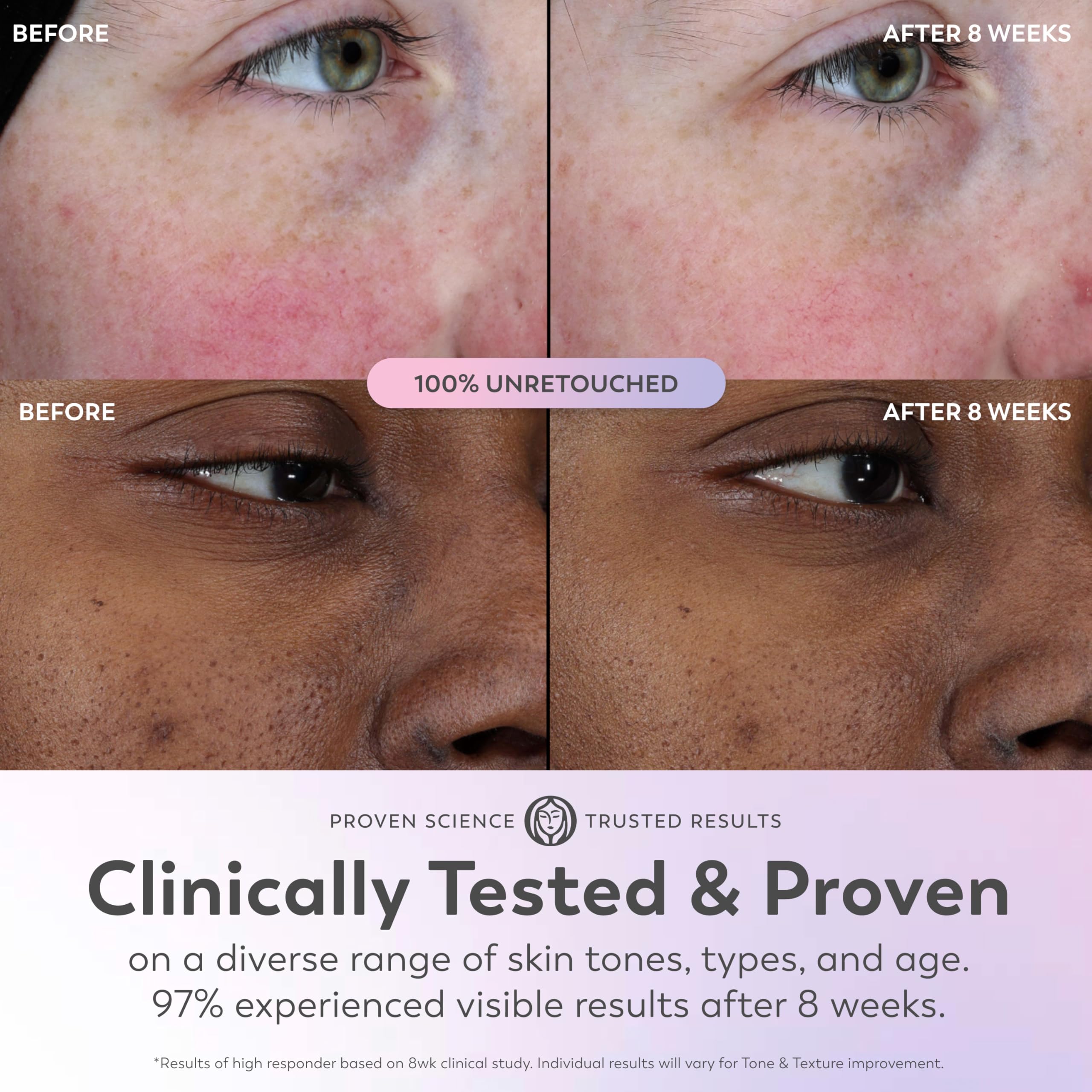 Olay Super Serum - Niacinamide, Vitamin C & E, Collagen Peptide, AHA - 5-in-1 Skin Care Benefits for Face - Healthy Glow, Brightening, Hydrating, Smoothing, Firming, Evens Tone, Anti-Aging in Pakistan