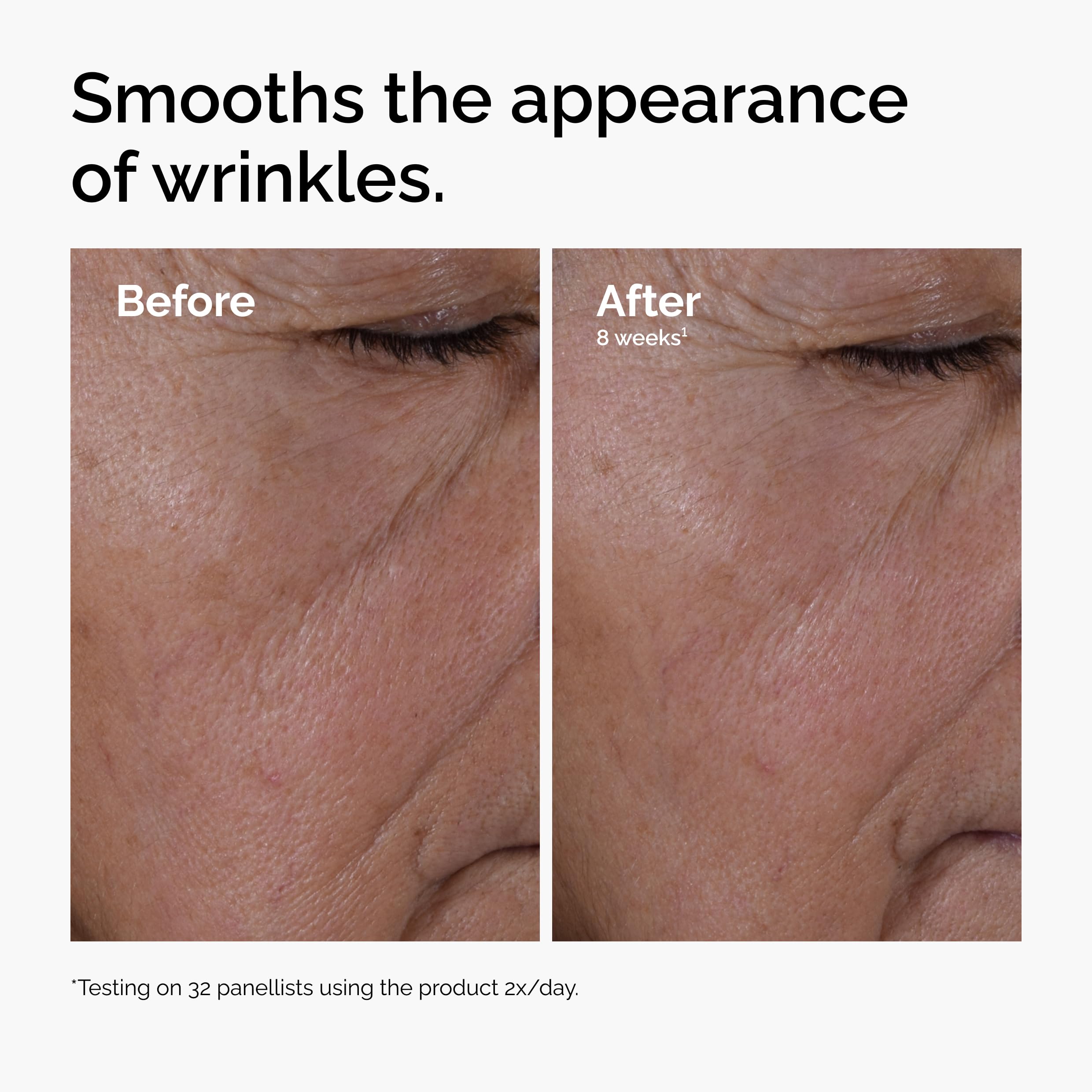 The Ordinary Multi-Peptide + Hyaluronic Acid, Anti-Aging Formula for Crow’s Feet, Elasticity & Firmness in Pakistan