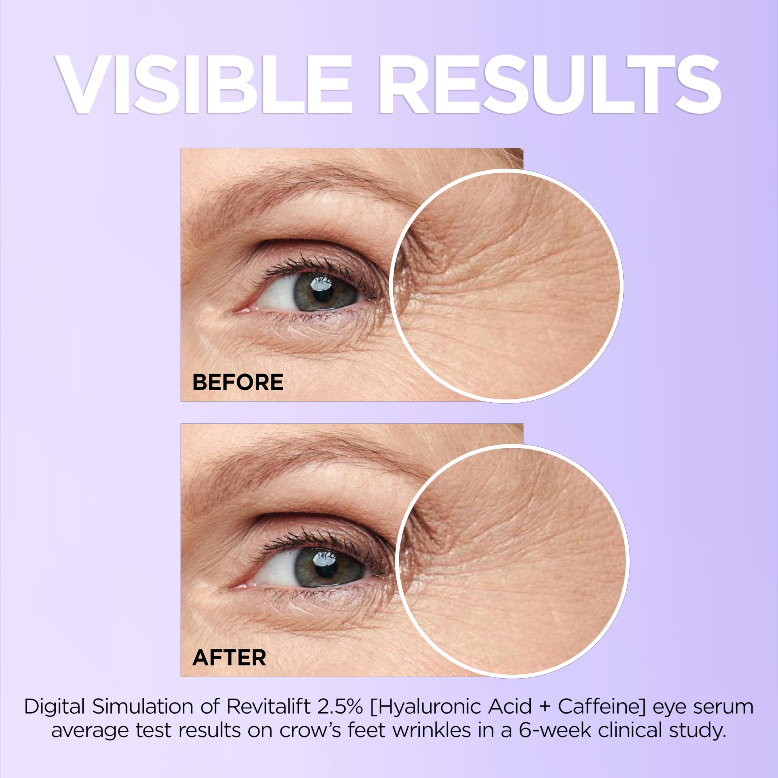 L'Oreal Paris Revitalift Hyaluronic Acid + Caffeine Hydrating Eye Serum for Dark Circles, Fragrance Free .67 fl. oz + Moisturizer Sample in Pakistan